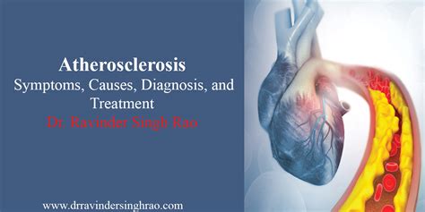 what is the impact of arteriosclerosis topic test|positive for atherosclerosis symptoms.